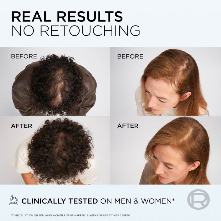 Elvital Growth Booster Hair Serum Duo