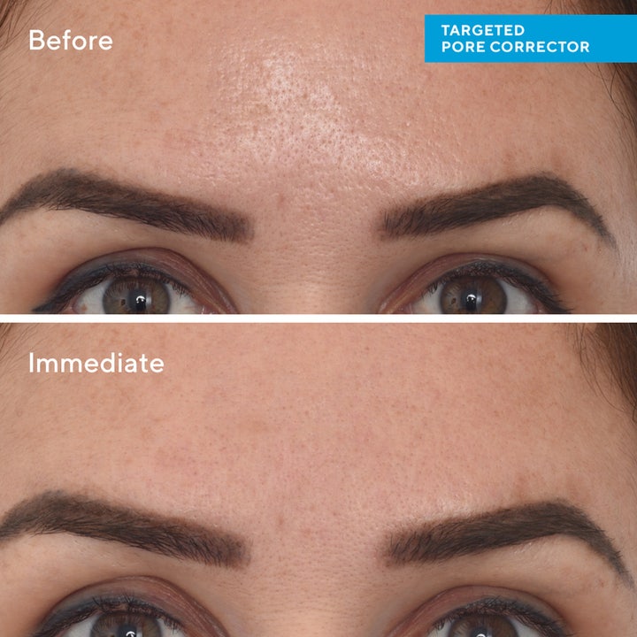 Murad Targeted Pore Corrector 15 ml porkorrigerare ger slätare hy med synliga före och efter resultat på porer.