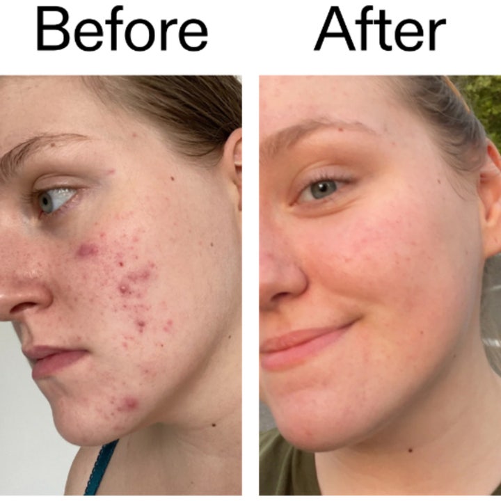 The INKEY List 15% Vitamin C and EGF Serum 30 ml lystergivande serum i vit flaska med droppande klar vätska.