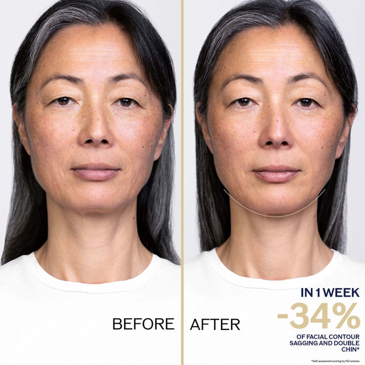 Shiseido Vital Perfection 80 ml återfuktande nattkräm för fastare hud med före och efter resultat på ansiktskontur.