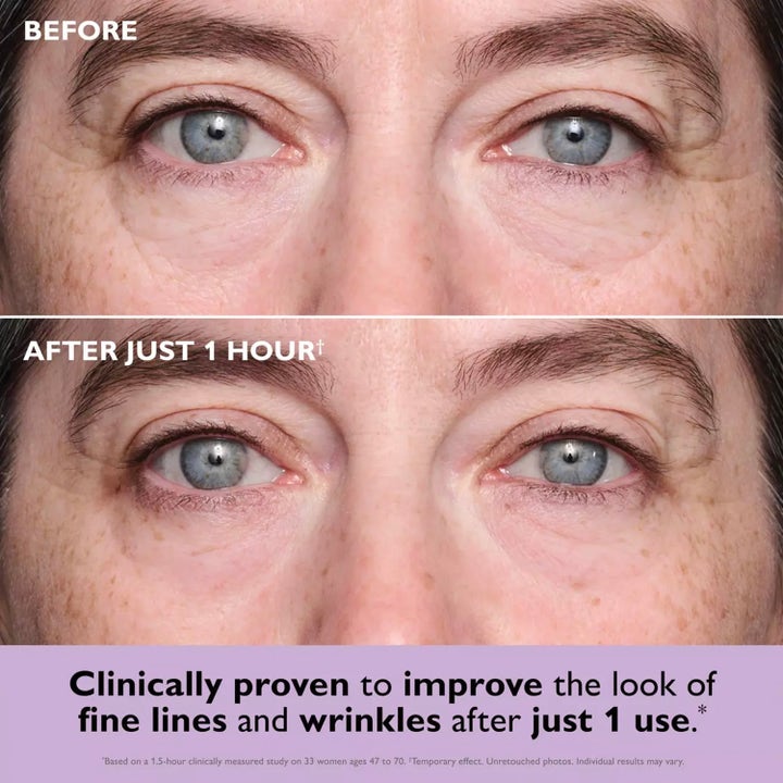 Peter Thomas Roth Instant FIRMx Eye Patches 8 st ögonmasker visar före och efter resultat på fina linjer.