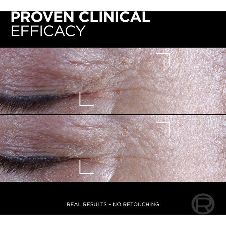 L'Oréal Paris Age Perfect Midnight Eye Cream 15 ml cell förnyelse ögonkräm visar klinisk effekt på rynkor.