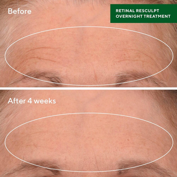 Murad Retinal ReSculpt Treatment 30 ml retinal serum visar före och efter resultat på pannrynkor efter 4 veckor