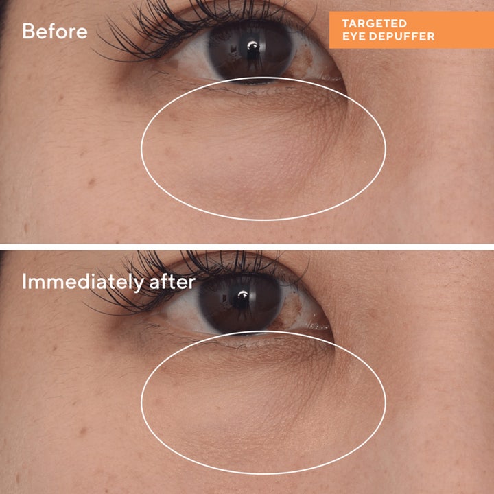 Murad Targeted Eye Depuffer 15 ml ögonkräm svullna ögon visar före och efter resultat med synlig anti-påsar effekt