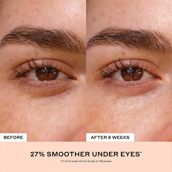 Ole Henriksen Truth Set 15 ml ögonkräm ger 27% slätare hud under ögonen i en klinisk före och efter studie