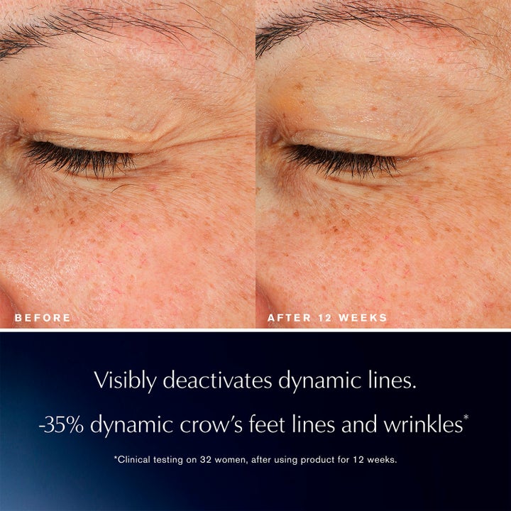 Estée Lauder Advanced Night Repair Eye Lift + Sculpt 15 ml ögonserum minskar rynkor och kråksparkar efter 12 veckor