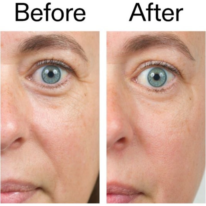 The INKEY List Bio-Active Ceramide 50 ml bioaktiv ceramid ansiktskräm visar före och efter resultat på rynkor.