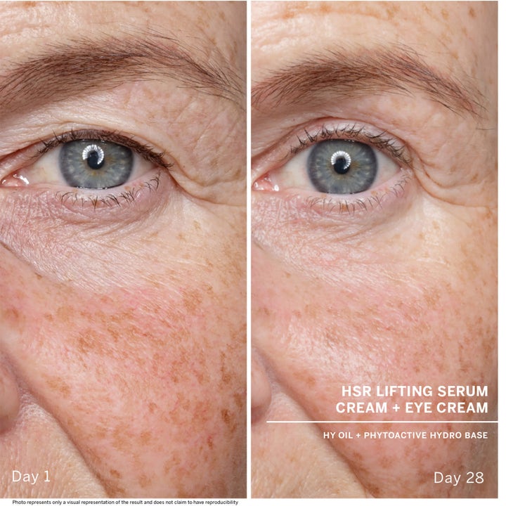 Babor HSR Lifting Eye Cream 30 ml anti-aging ögonkräm mot rynkor före och efter 28 dagars användning