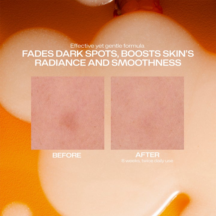 Lumene Dark Spot Serum 30 ml serum mot mörka fläckar visar före och efter resultat för mer lyster och jämnhet.