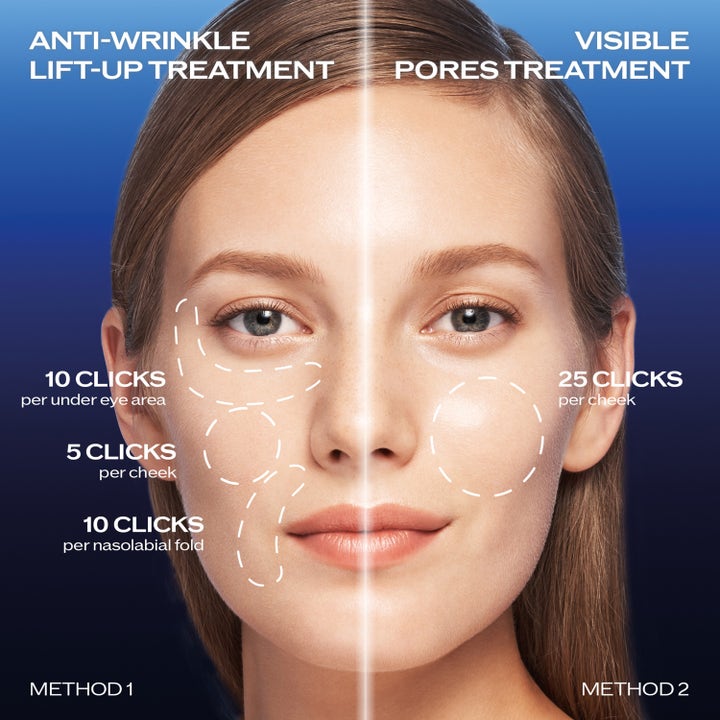 Shiseido Bio Performance 2.0 Micro Needle 1,4 ml spot treatment visar applicering mot rynkor och synliga porer på ett ansikte