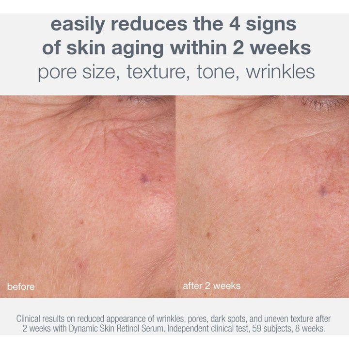 Dermalogica Skin Aging Solutions 70 ml serum före och efter bilder som visar reducerade rynkor och jämnare hudton