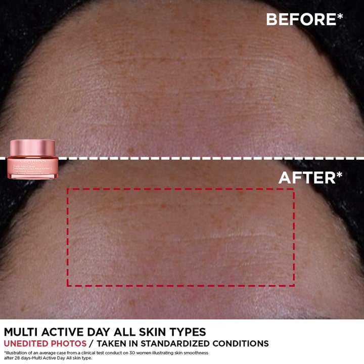 Clarins Multi-Active Jour 50 ml lystergivande dagkräm med niacinamide visar före- och efterresultat på pannrynkor.