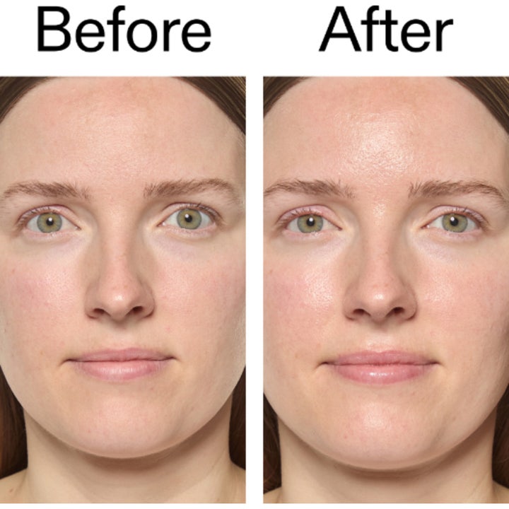 The INKEY List Exosome Hydro-Glow Complex 30 ml antiaging serum ger hudförnyelse och lyster i en före- och efterbild.