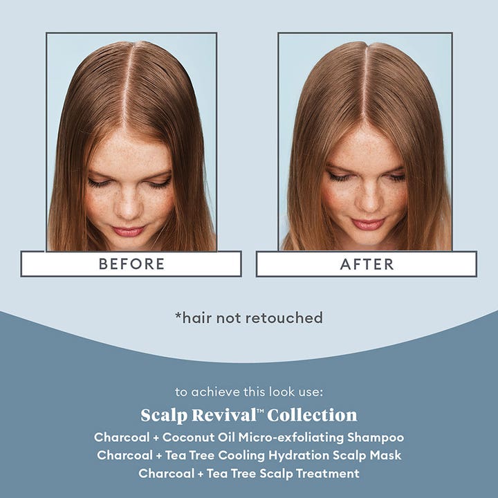 Scalp Revival™ Scalp Soothing Solutions Set