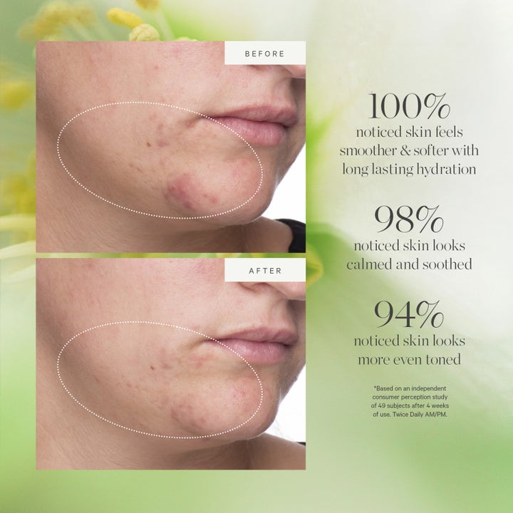 KORA Organics Active Algae Lightweight Moisturizer 15 ml organisk kräm ger jämnare hudton i före- och efterbilder.