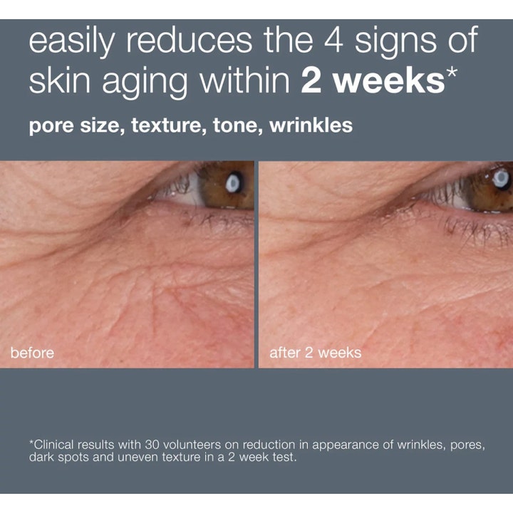 Dermalogica Dynamic Skin Retinol Serum 10 ml anti-rynk serum hudföryngring visar före och efter resultat på rynkor
