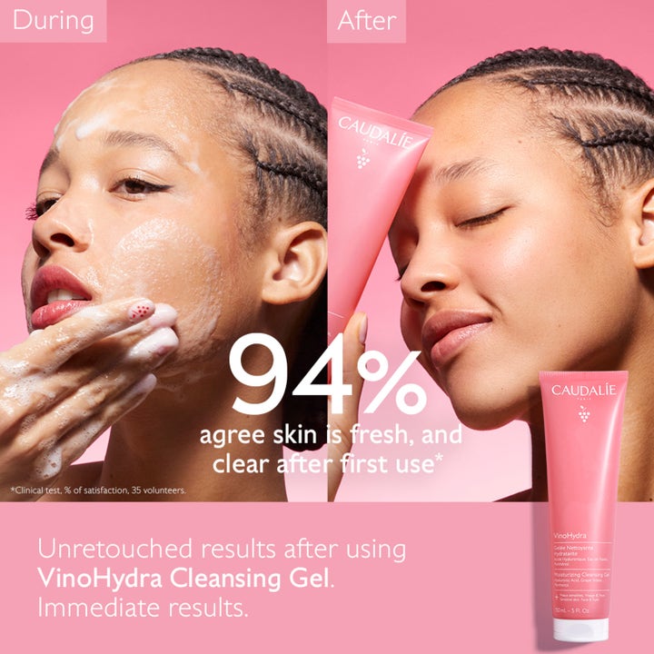 Caudalie Vinohydra Moisturizing Cleansing Gel 150 ml ger fräsch hy i före och efter bild på kvinna