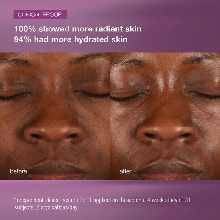 Dermalogica MultiVitamin Power Recovery Cream Duo hudvård före och efter kliniska resultat för lyster och fukt