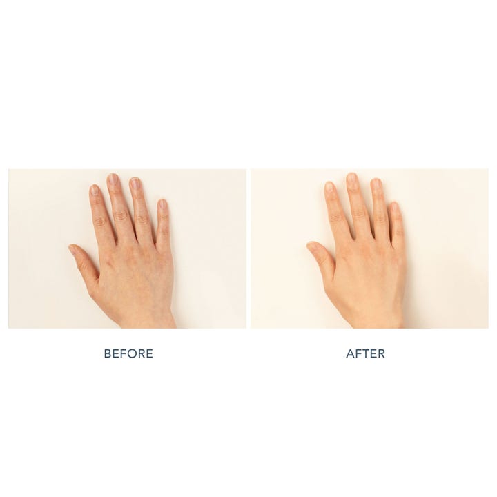 FAQ Swiss FAQ 221 LED Hand Mask 1 st anti-rynk handbehandling före och efter resultat på handrygg