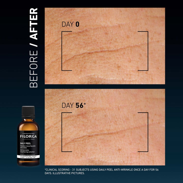 Filorga Daily Peel 50 ml ansiktspeeling mot rynkor visar före och efter 56 dagar bredvid mörk glasflaska med retinol.