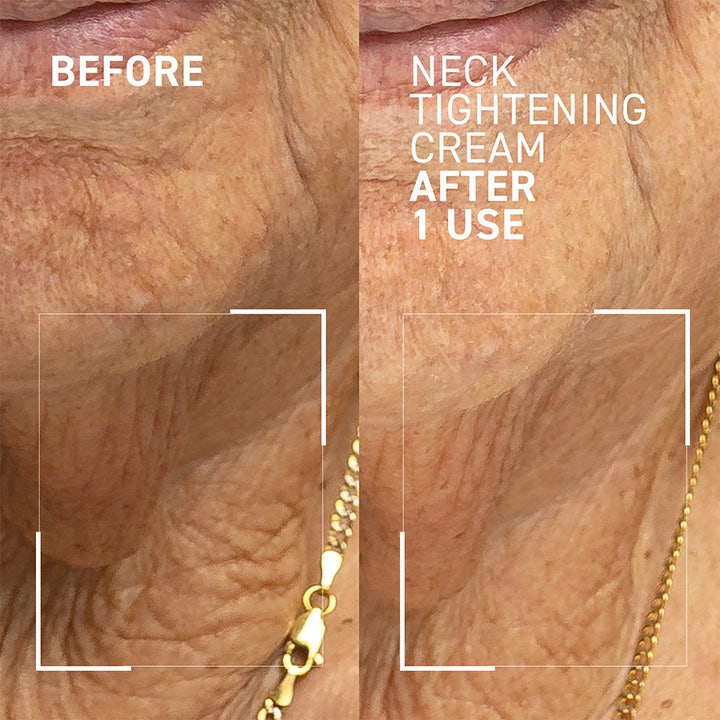 Dr Brandt Neck Tightening Cream 50 g halskräm mot rynkor visar resultat för nackuppstramning efter en användning