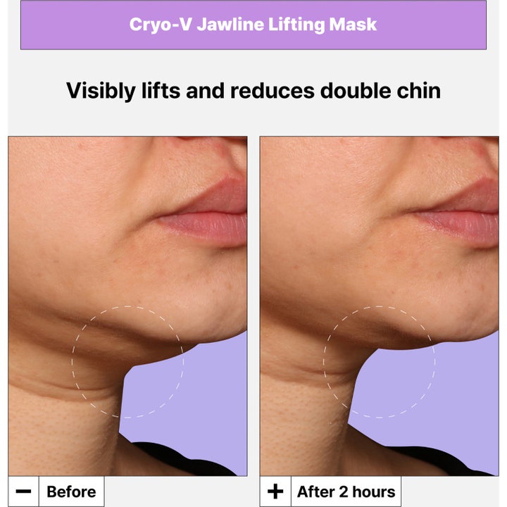 Cryo V-Sculpt Jawline Lifting Mask