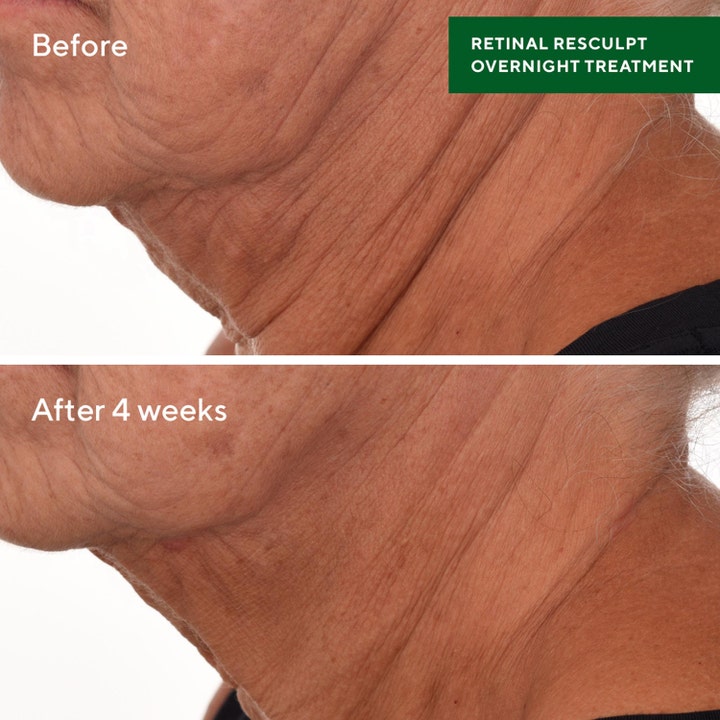 Murad Retinal ReSculpt Treatment 30 ml retinal serum visar före och efter resultat på rynkor på halsen.