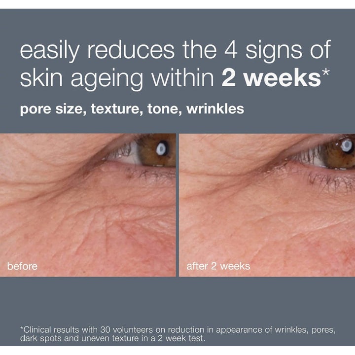 Dermalogica Retinol Renewal Duo 2 x 30 ml serum före och efter resultat på rynkor och porer vid ögat efter två veckor