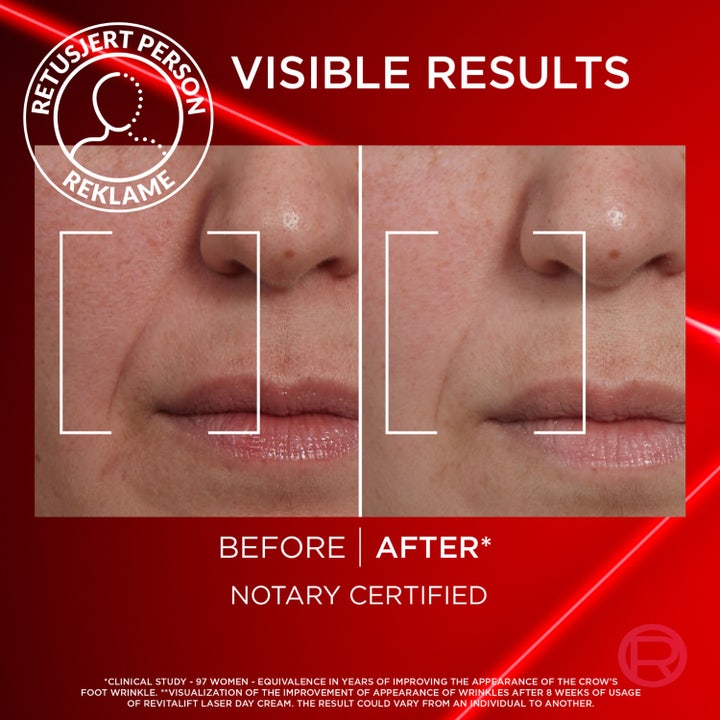 L'Oréal Paris Laser Advance Day 50 ml anti age ansiktskräm ger huduppstramning och lyster på bild med kvinna.