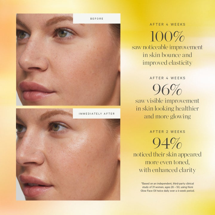 KORA Organics Noni Glow Face Oil 10 ml ger lyster i före och efterbilder med resultat från klinisk studie.