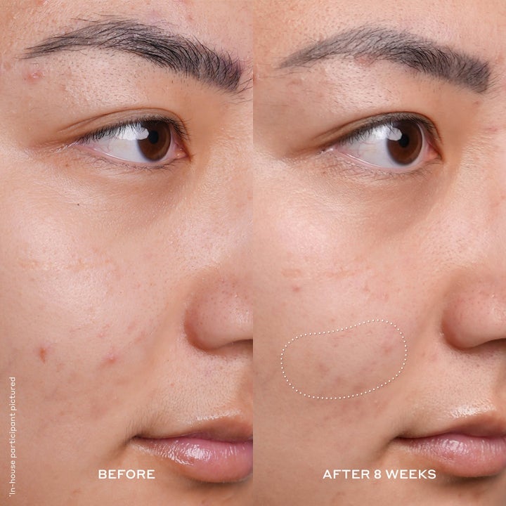 Ole Henriksen Vitamin C Boost lystergivande vitamin c serum före och efter 8 veckor som ger jämnare hudton.