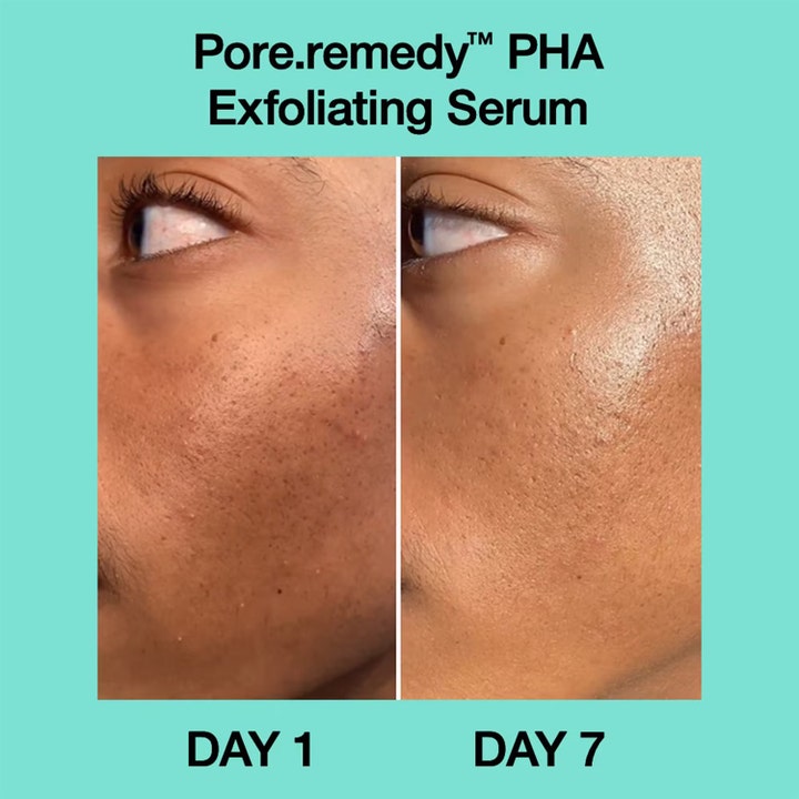 Dr.Jart+ Pore-remedy PHA Exfoliating Serum 30 ml serum med pha visar resultat på porer och hudtextur från dag 1 till 7.