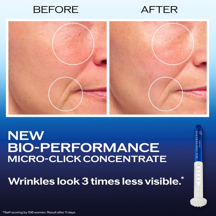 Shiseido Bio Performance 2.0 Micro Needle 1,4 ml spot treatment visar före och efter resultat för reducerade rynkor.
