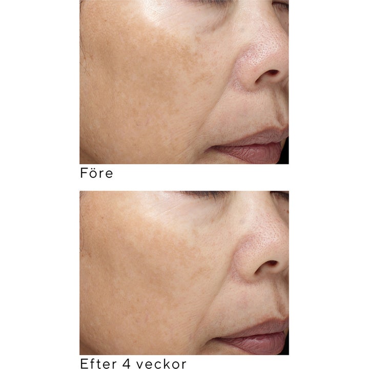 Murad Essential-C Firming Radiance Day Cream 50 ml vitamin C ansiktskräm visar före och efter resultat på hudens pigmentering.