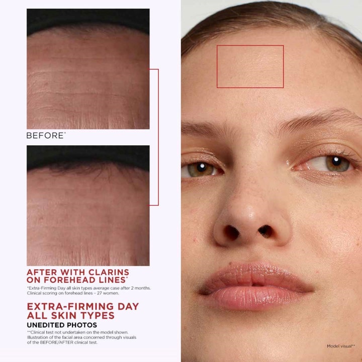 Clarins Extra-Firming Jour 50 ml ansiktskräm med omedelbar lyfteffekt visar före och efter resultat på rynkor i pannan