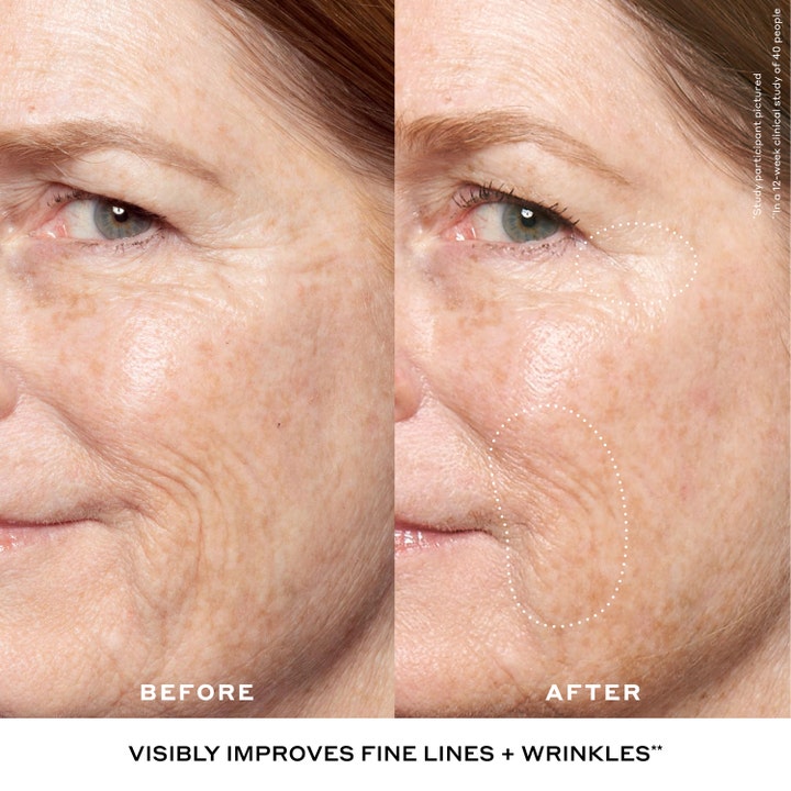Ole Henriksen Double Rewind 0.3% Retinol Serum 30 ml före och efter resultat på rynkor och fina linjer