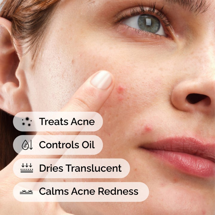 The Ordinary Sulfur 10% Powder-To-Cream Concentrate 5 g spot treatment behandlar akne och dämpar rodnad på huden.