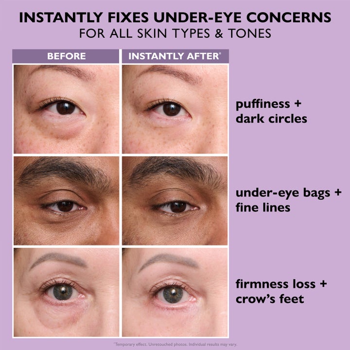 Peter Thomas Roth Instant FIRMx Eye 20 ml ögonkräm visar före och efter resultat på påsar och fina linjer