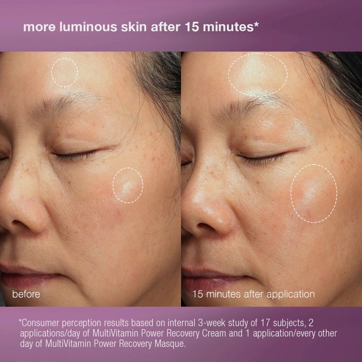 Dermalogica Stressed Skin Recovery System Duo hudvård ger lyster med före och efter bilder på ansikte efter 15 minuter