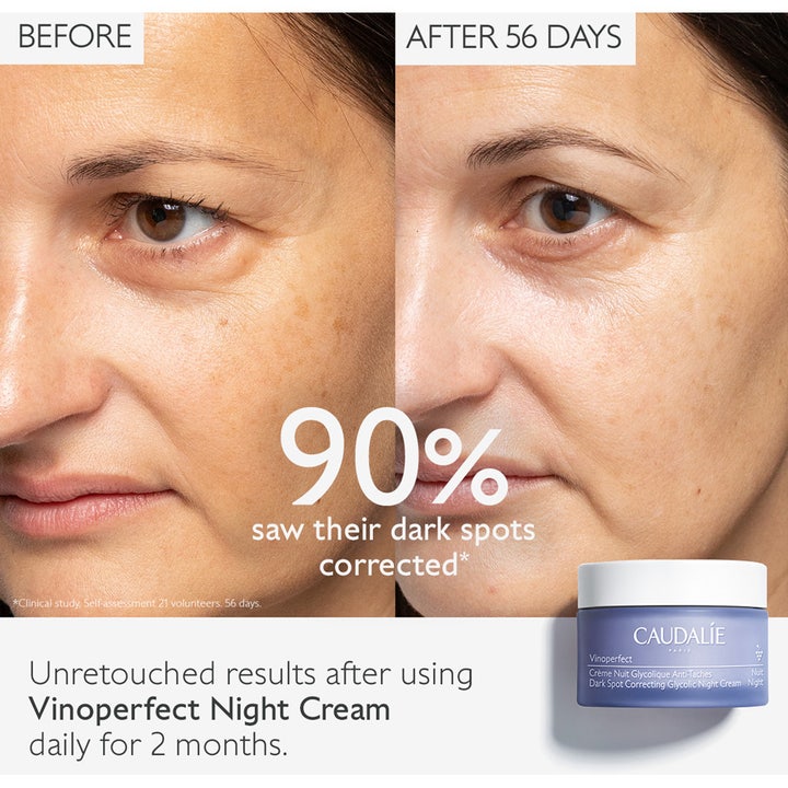Caudalie Vinoperfect 50 ml fläckkorrigerande nattkräm visar före och efter resultat på mörka fläckar efter 56 dagar.