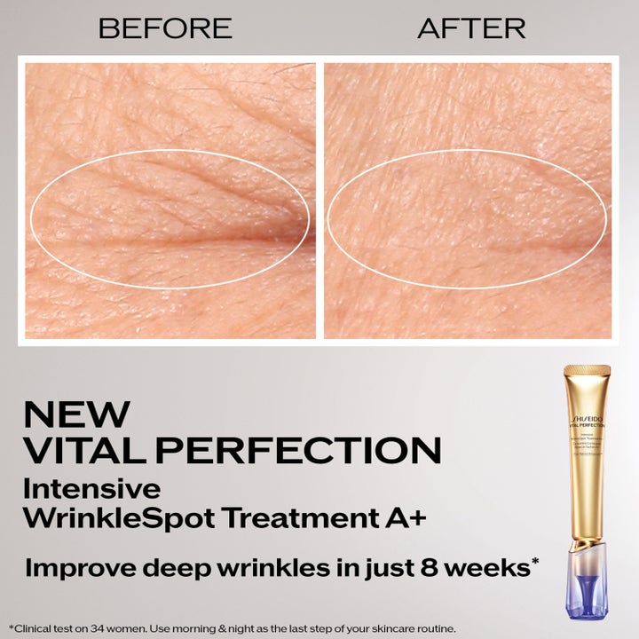 Shiseido Vital Perfection Intensive Wrinklespot Treatment A+ 20 ml mot rynkor med före och efter bilder samt guldtub