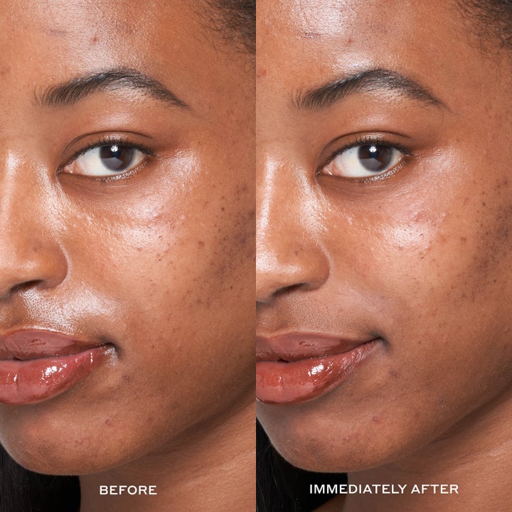 Ole Henriksen Dewtopia 25% Acid Flash Facial 50 ml syrabehandling ansikte före och efter bild som ger lyster