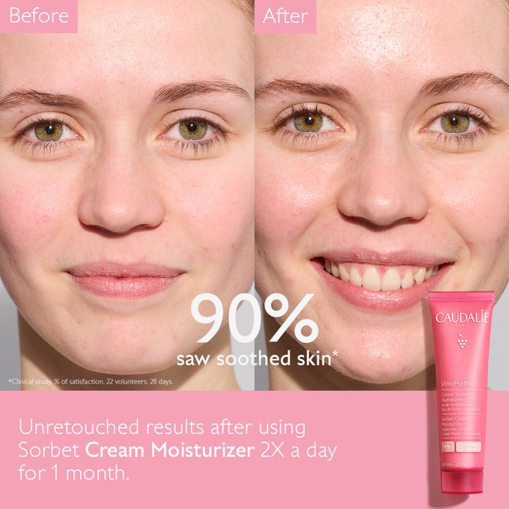 Caudalie Vinohydra Sorbet Cream Moisturizer 60 ml återfuktande ansiktskräm visar före och efter resultat där 90% fick lugnad hud.
