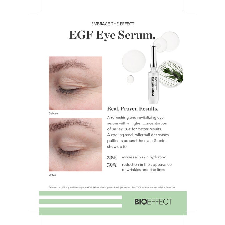 Bioeffect EGF Eye Serum 6 ml ögonserum anti-age visar före och efter resultat på rynkor och fina linjer.