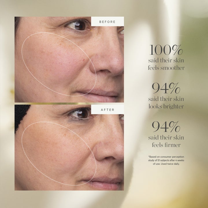 KORA Organics Turmeric Glow Moisturizer 50 ml gurkmeja hudvård visar före och efter resultat för fastare hud med lyster