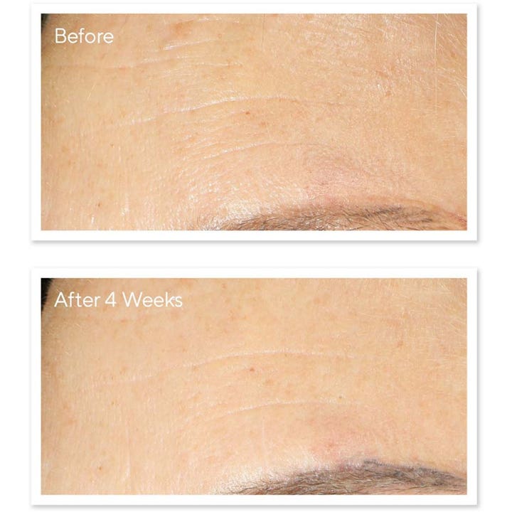 Murad Resurgence Retinol Youth Renewal Night Cream 50 ml effektiv nattkräm med retinol visar resultat på rynkor efter 4 veckor.