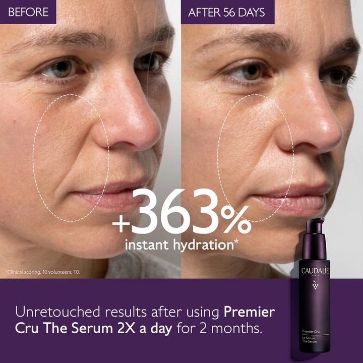 Caudalie Premier Cru The Serum 30 ml anti aging serum caudalie ger fukt och visar före och efter resultat.
