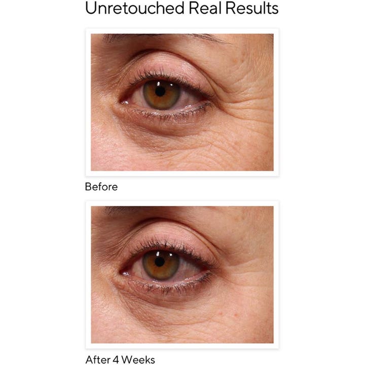 Murad Resurgence Retinol Youth Renewal Eye Serum 15 ml ögonserum med före och efter resultat på rynkor efter 4 veckor