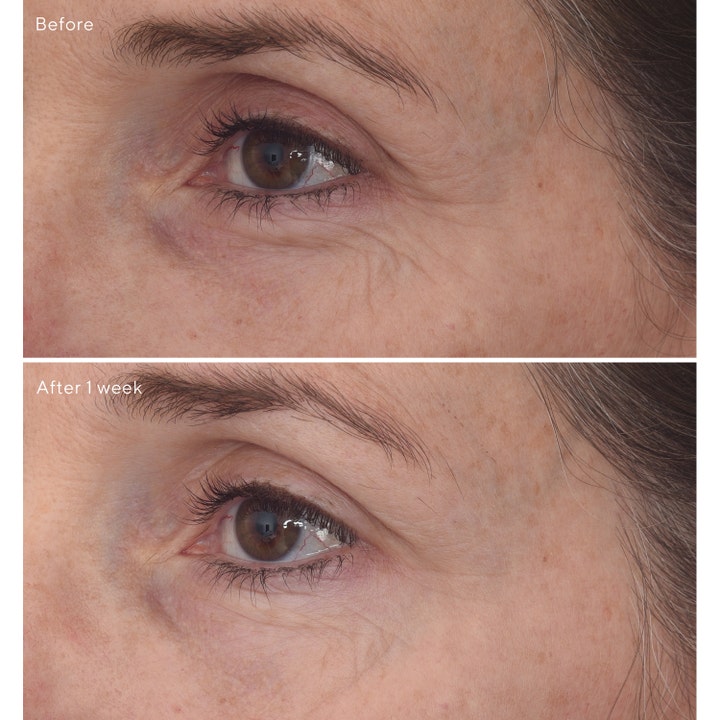 Murad Retinal ReSculpt Eye Lift Treatment 15 ml ögonkräm retinol före och efter resultat som ger slätare ögonkontur