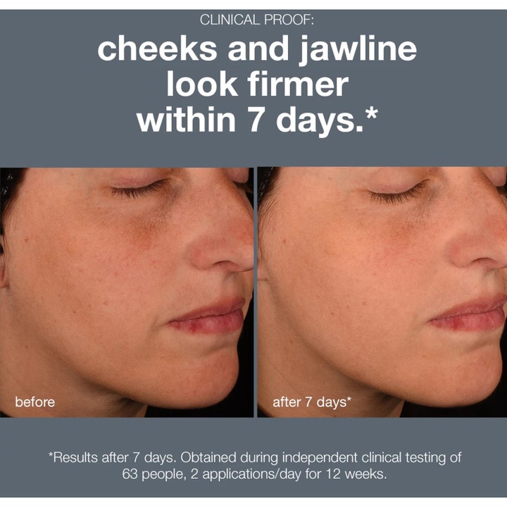 Dermalogica Pro-Collagen Banking Serum 30 ml serum för fastare hud visar resultat på kinder och käklinje efter 7 dagar